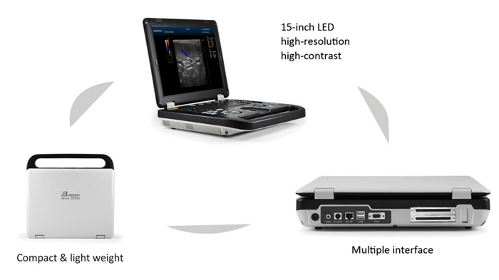 Bondway ES250 digital laptop color doppler ultrasound machine